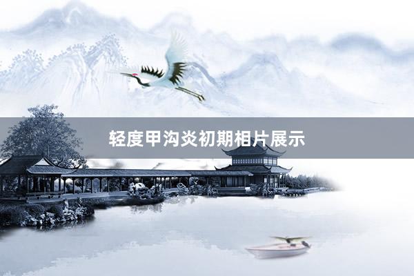 轻度甲沟炎初期相片展示